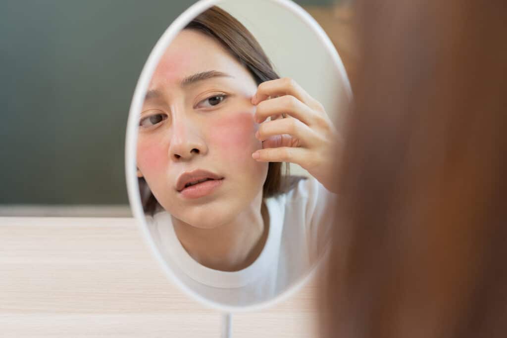 Dermatology, puberty asian young woman, girl looking into mirror